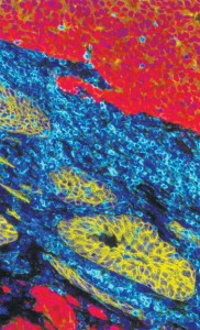 Deo istraživanja prof. Bonoa, koje ‚daje novu nadu pacijentima s rakom prostate