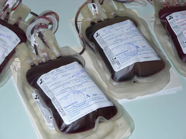 Najređe krvne grupe su AB, AB-Rh negativ, kao i B pozitivnog i negativnog Rh faktora